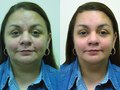 Before and After: Digital Retouch