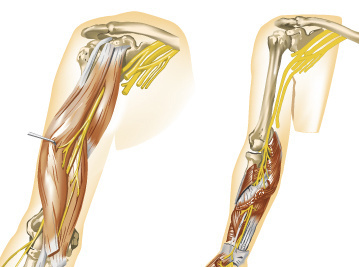 Musculo skeletal renderings