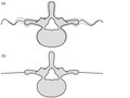 Elsevier : Therapeutic Exercise for Lumbopelvic Stabilization