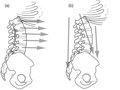 Elsevier : Therapeutic Exercise for Lumbopelvic Stabilization