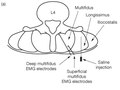Elsevier : Therapeutic Exercise for Lumbopelvic Stabilization