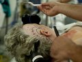 Brain Surgery
