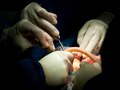 Brain Surgery