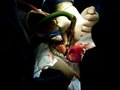 Brain Surgery