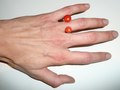 Coral/14 kt ring
