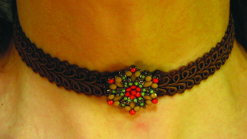 Button & Lace Chocker