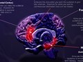 etna application - neuroplanning