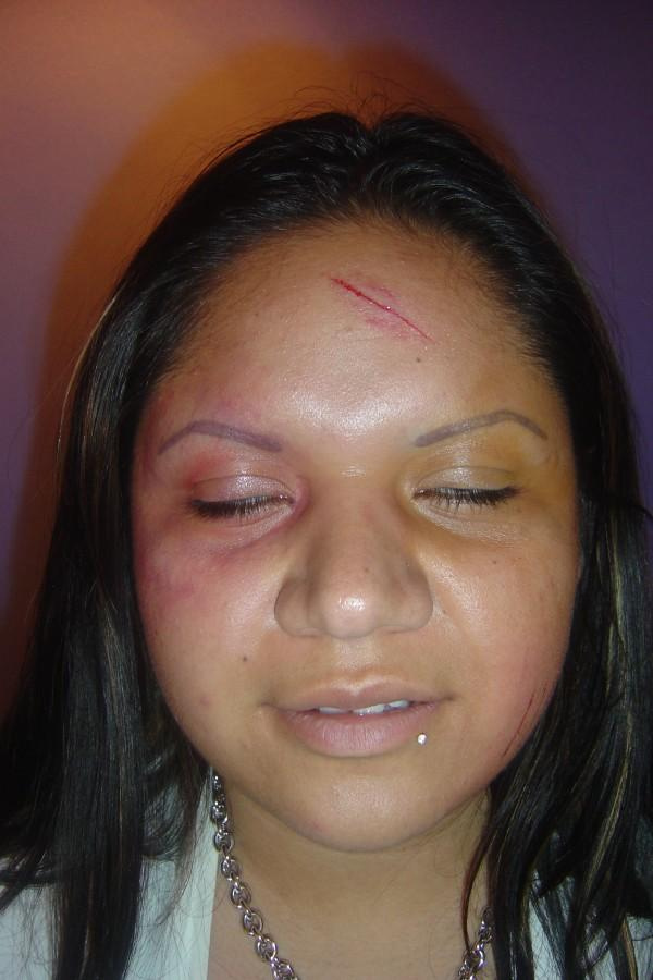 Cat Scratches, Fresh Brusing, Cut's,